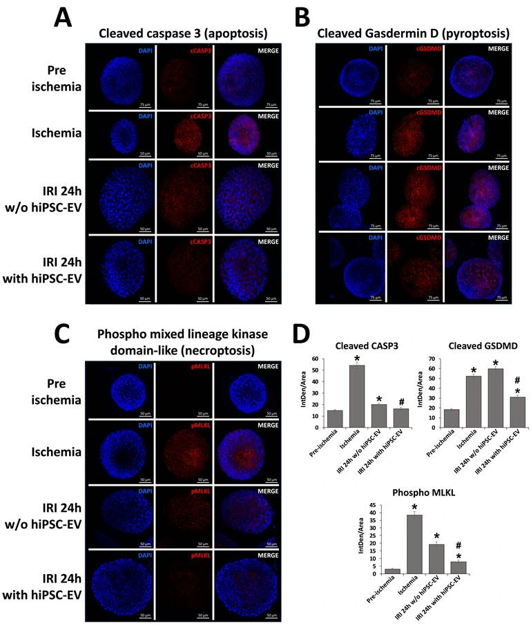 气道类器官 cCASP3、cGSDMD、pMLKL 染色与有无囊泡处理的定量比较