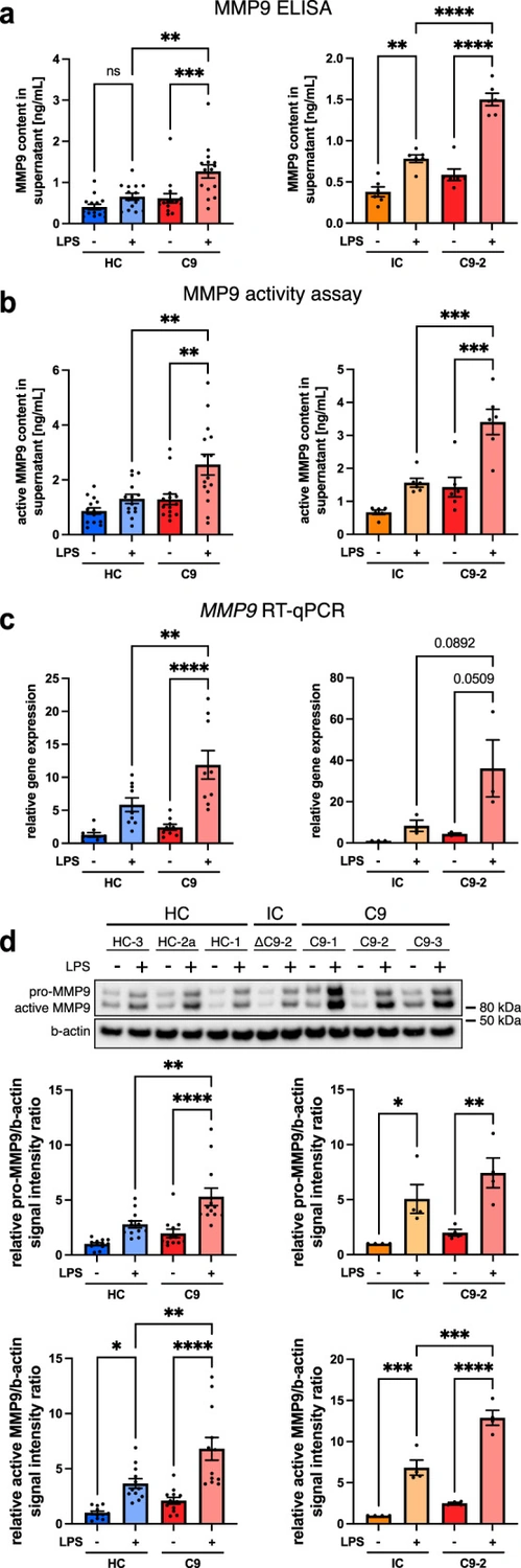 小胶质细胞上清的 MMP9 含量、活性,以及 RNA 和蛋白检测。