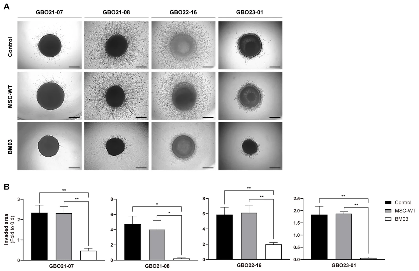 原文 Figure 3 A–B:四个患者模型的侵袭显微图和归一化侵袭面积。