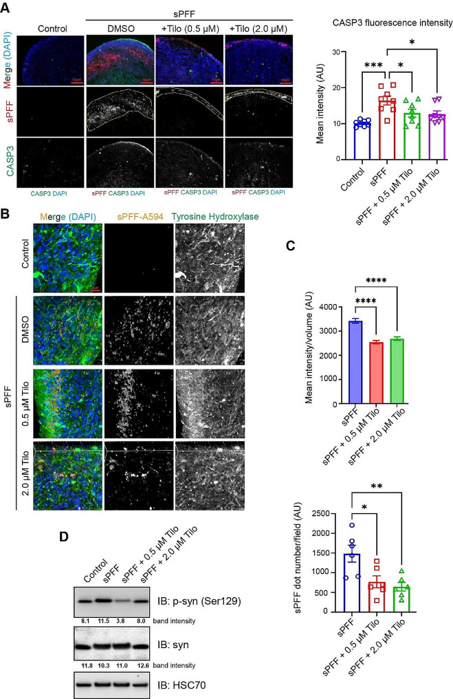不同给药条件下，中脑类器官的 α-突触核蛋白纤维、caspase-3 信号与 α-突触核蛋白磷酸化比较。