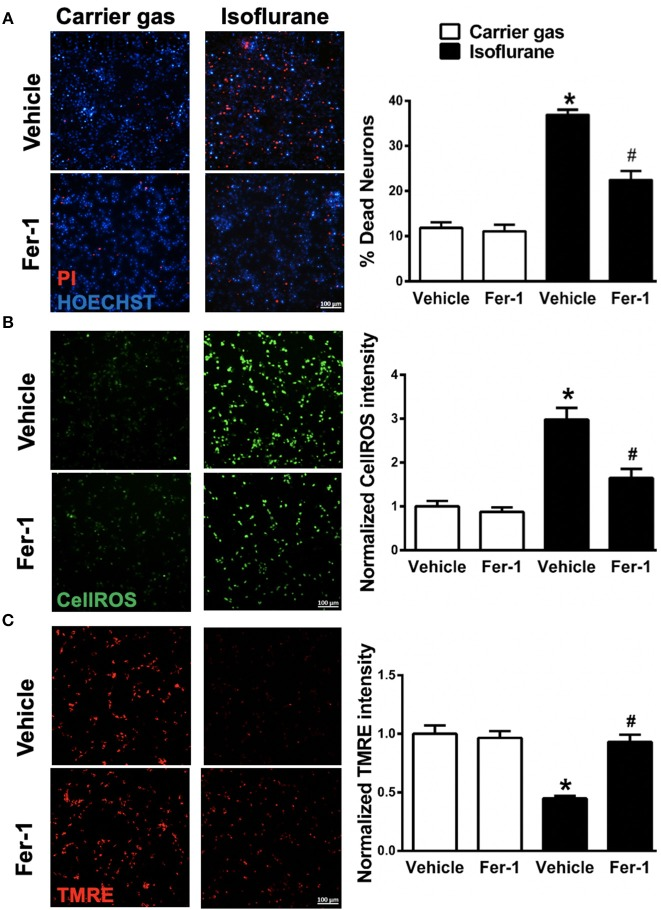 异氟烷暴露及 ferrostatin-1 预处理后,小鼠原代皮层神经元的细胞死亡、活性氧和线粒体膜电位比较。