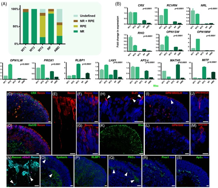 原研究第 150 天视网膜类器官细胞组成图与分层免疫染色全图