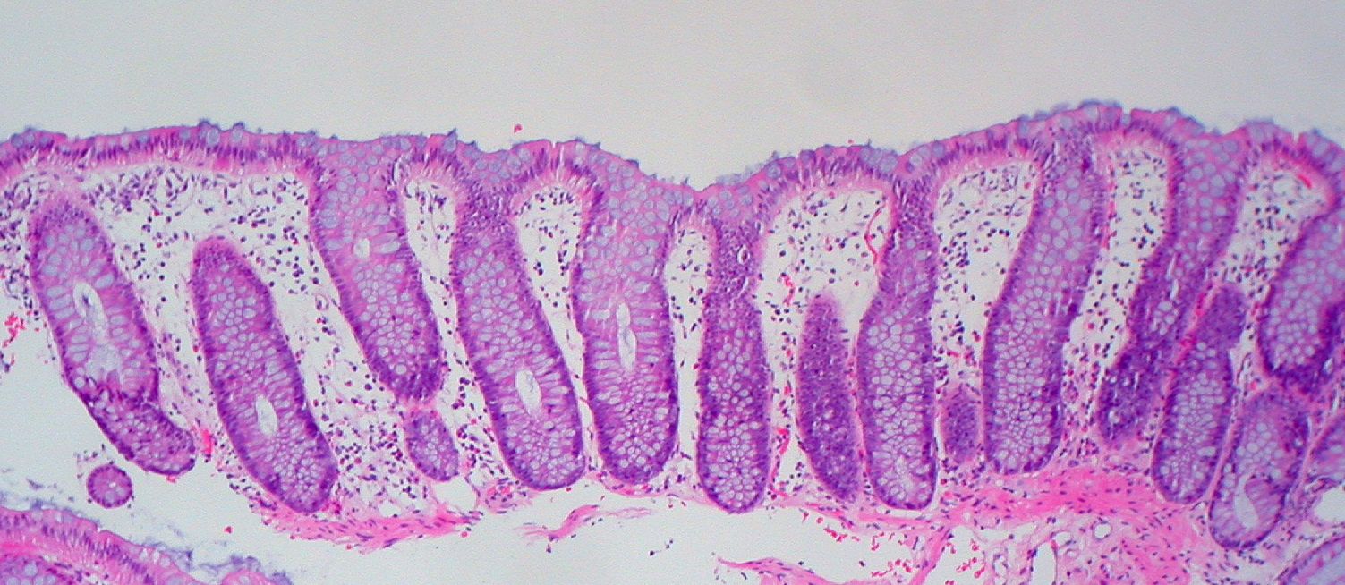 正常结肠黏膜组织切片。(Ed Uthman, MD;CC BY-SA 2.0)