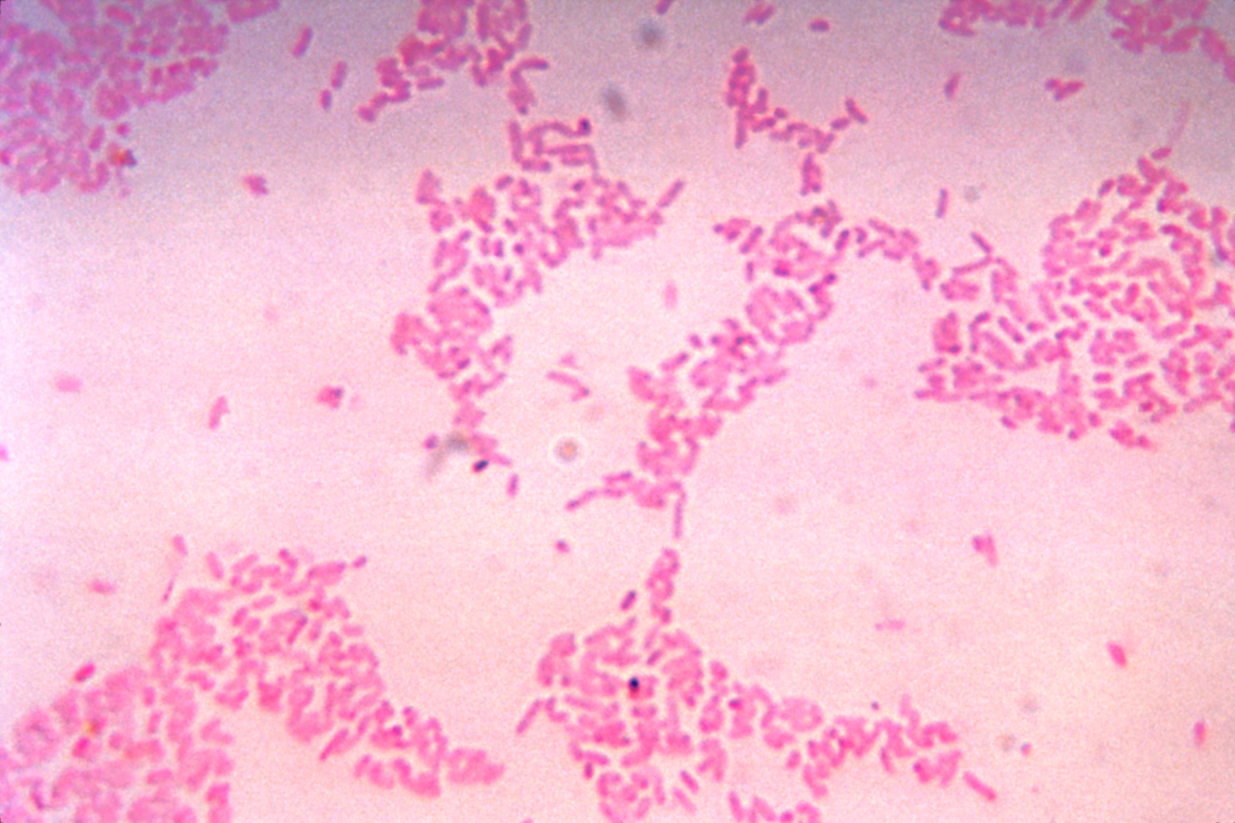 Bacteroides thetaiotaomicron 的显微图像。